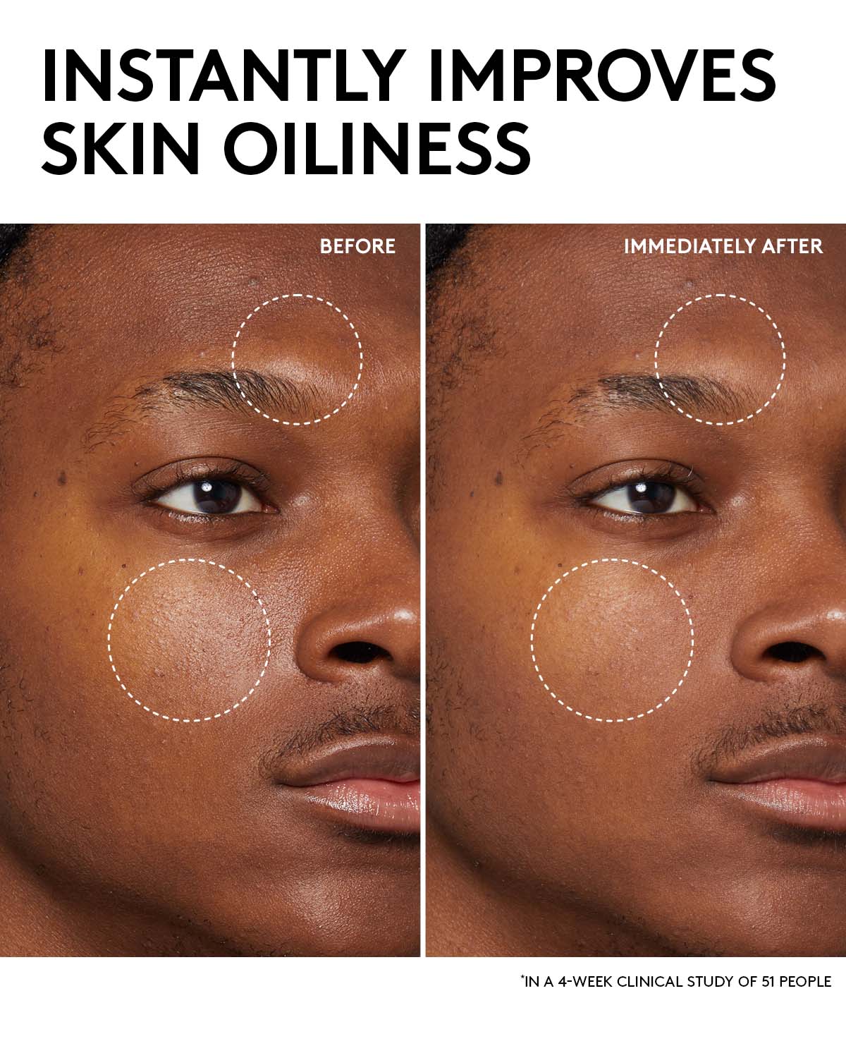 Fenty Skin Start’rs Full-Size Bundle: Oily Skin Edition - Pack