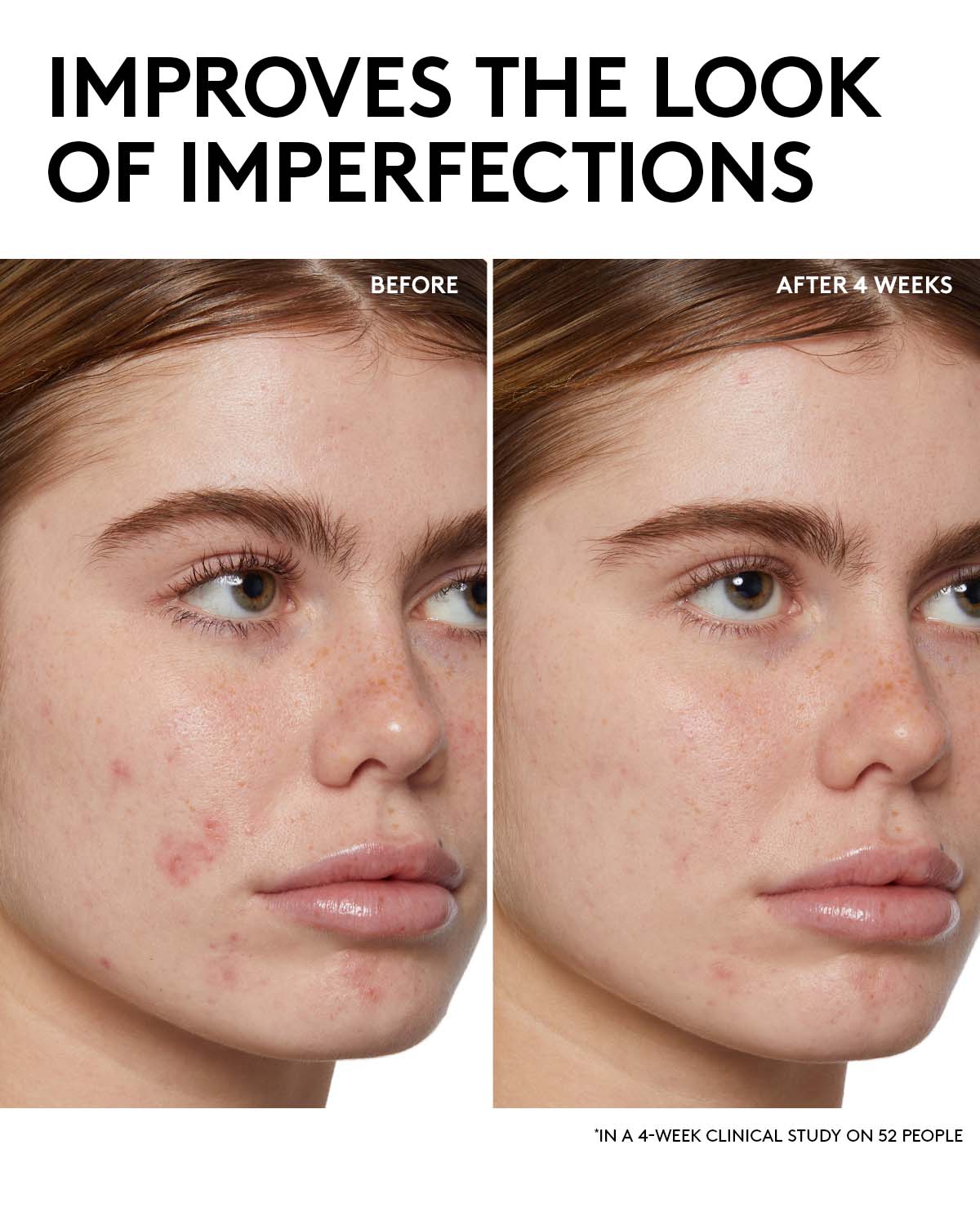 Fenty Skin Start’rs Full-Size Bundle: Oily Skin Edition - Pack