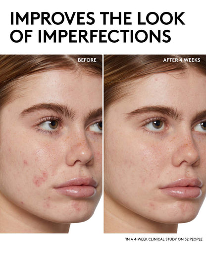 Fenty Skin Start’rs Full-Size Bundle: Oily Skin Edition - Pack