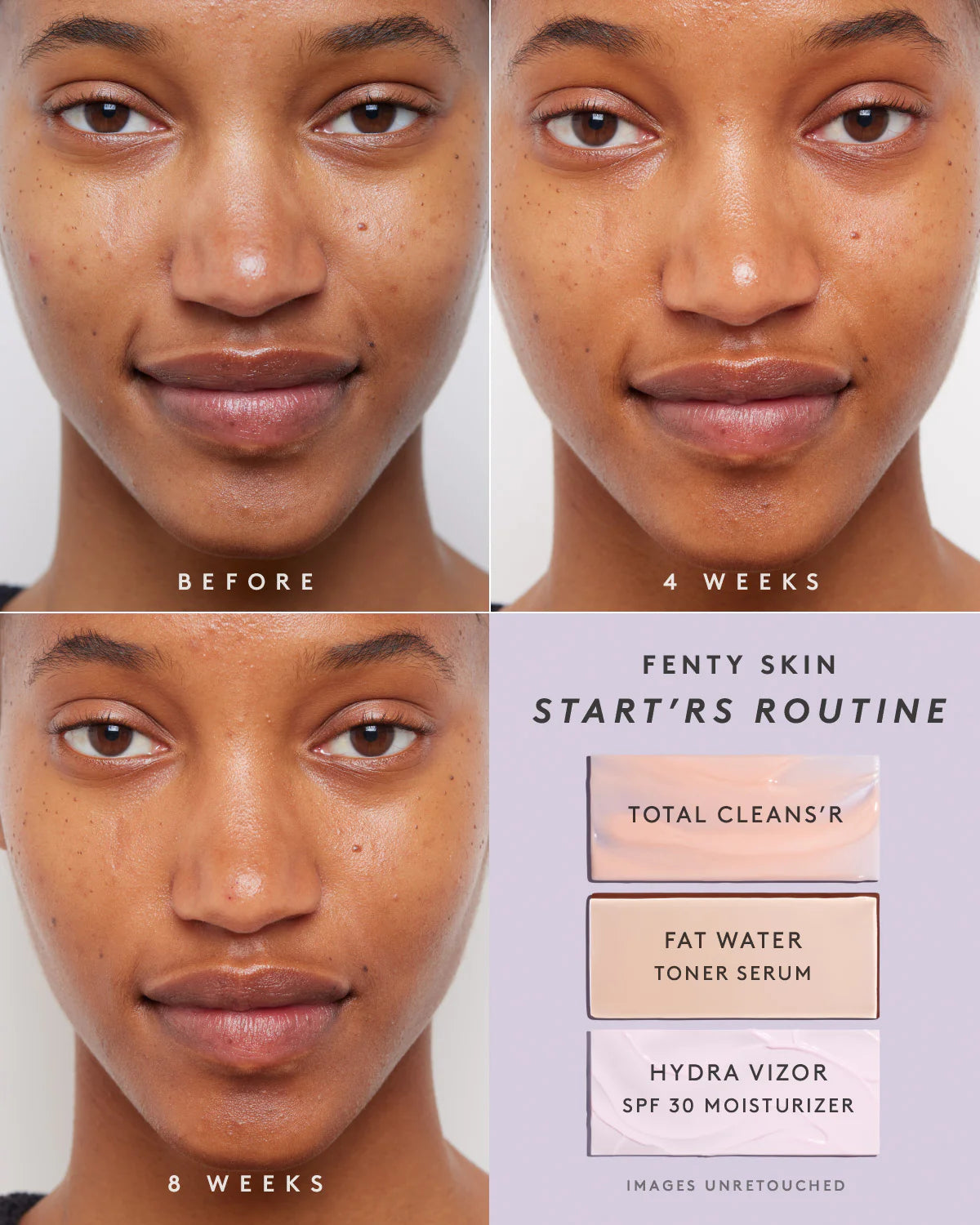 Fenty Skin Start’rs Full-Size Bundle - Pack